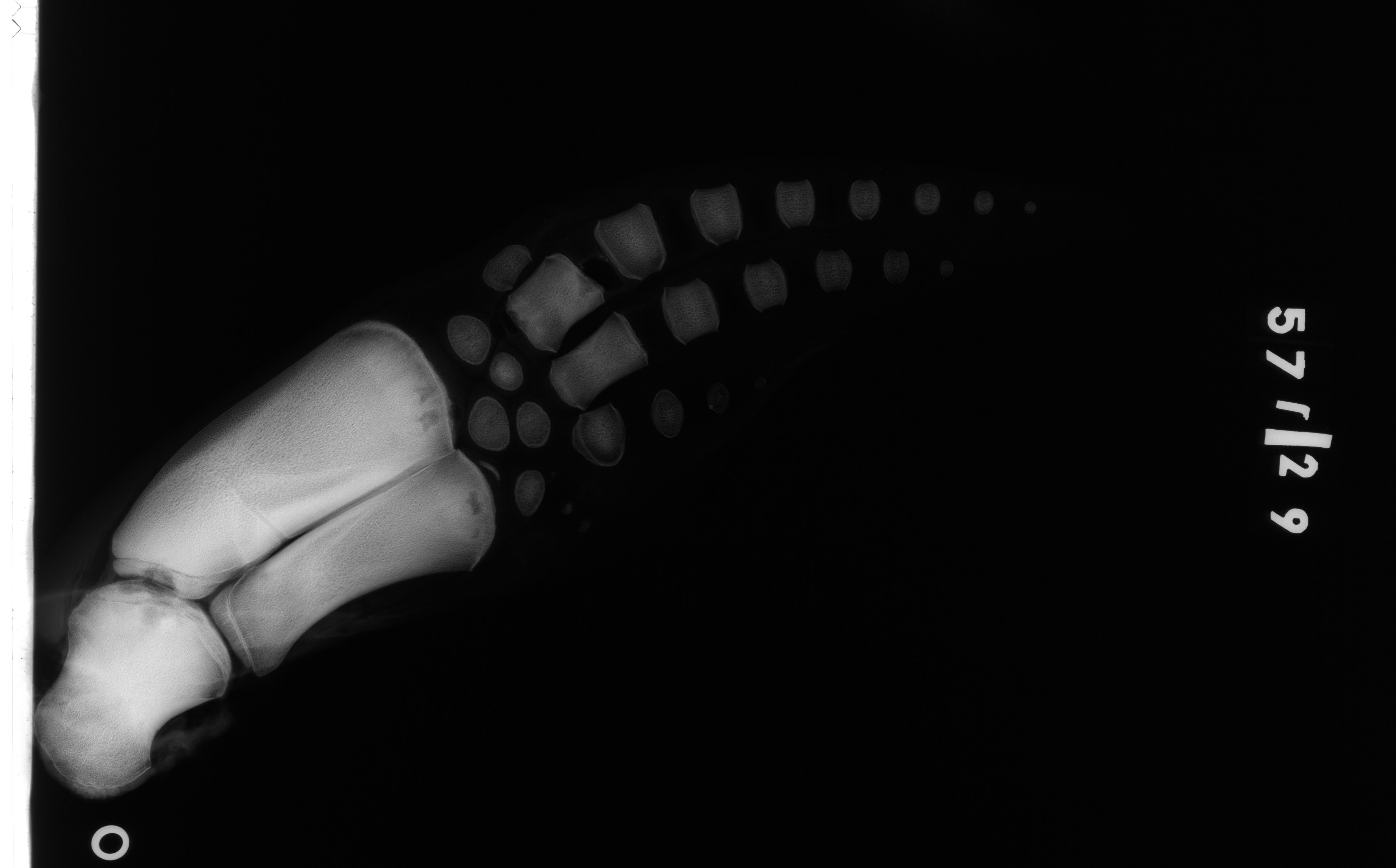 Röntgenbild eines menschlichen Beins mit einem Knöchelbruch, mit schwarzem Hintergrund und Text auf der rechten Seite.